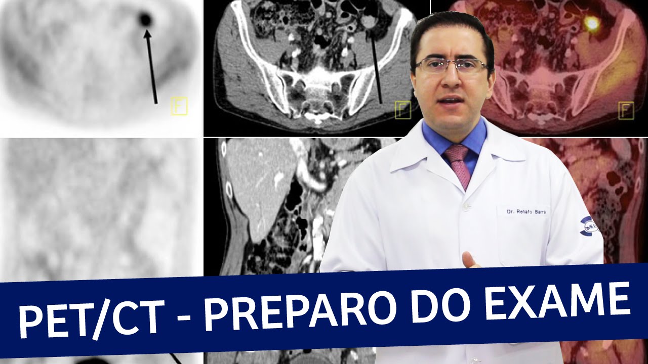 PET Scan ou PET/CT | Preparo do exame | IMEB