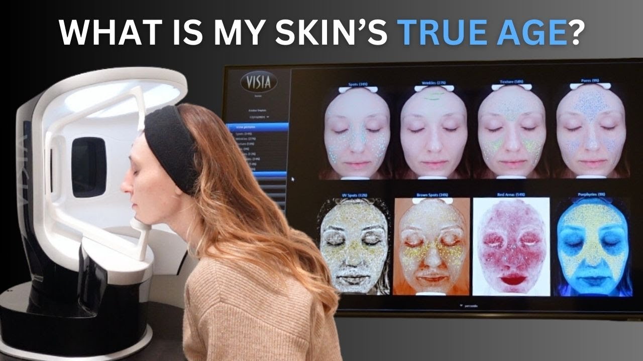 Visia Skin Analysis - Discovering My True Skin Age!