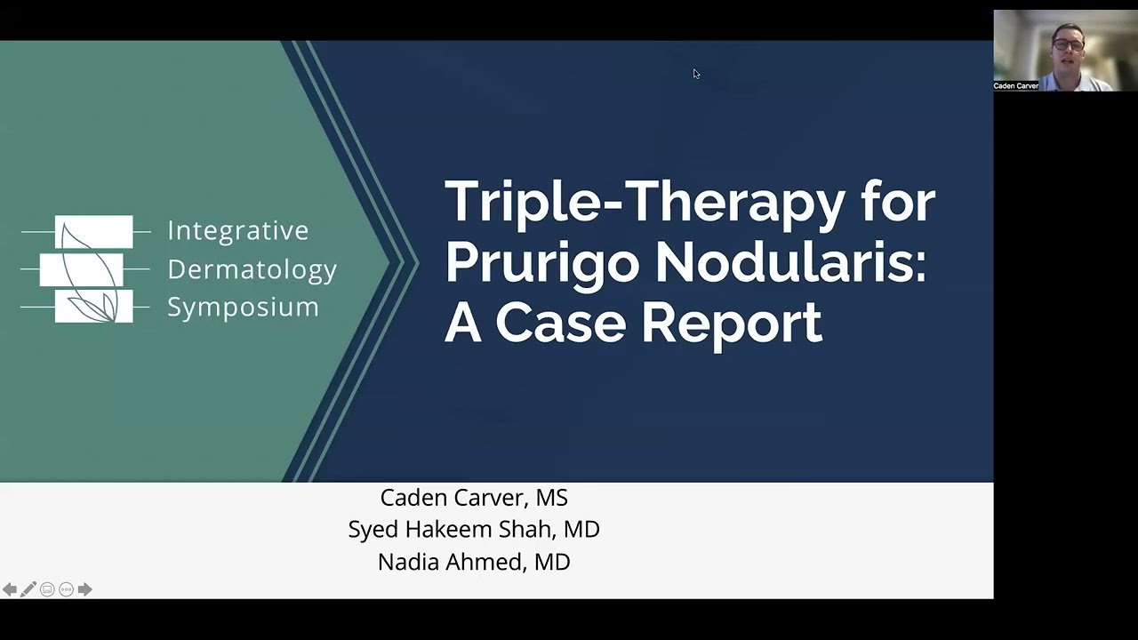Triple-Therapy for Prurigo Nodularis: A Case Report