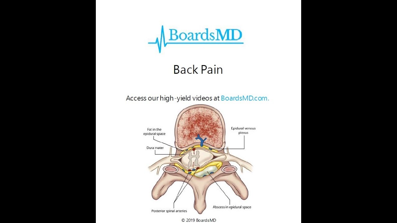 Back Pain | USMLE Surgery | @BoardsMD