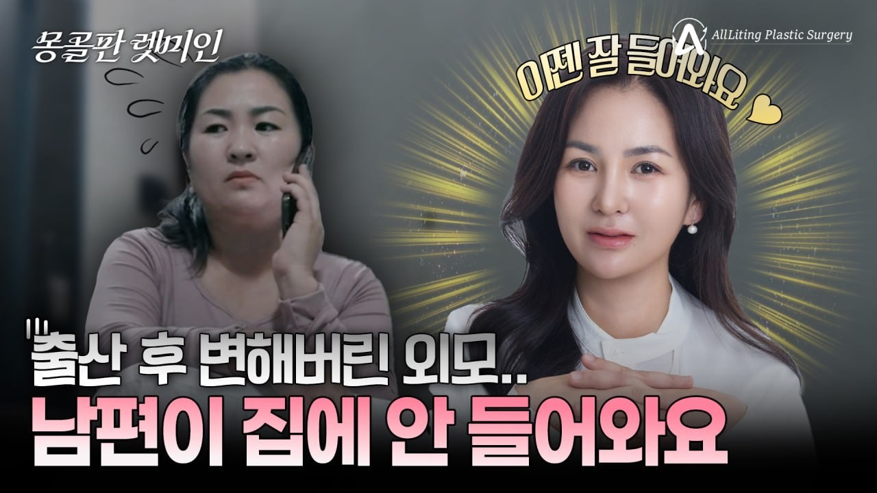 출산후 변해버린 외모에 달라진 남편! 그녀가 예뻐진후 바뀐 행동은? | 올리팅성형외과 석효현 원장 #몽골 #성형