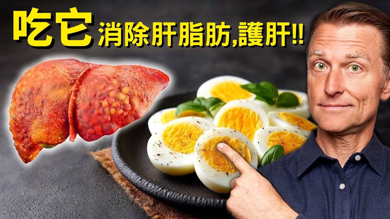 不想換肝嗎？吃6種食物消除肝脂肪、護肝!!  柏格醫生 Dr Berg