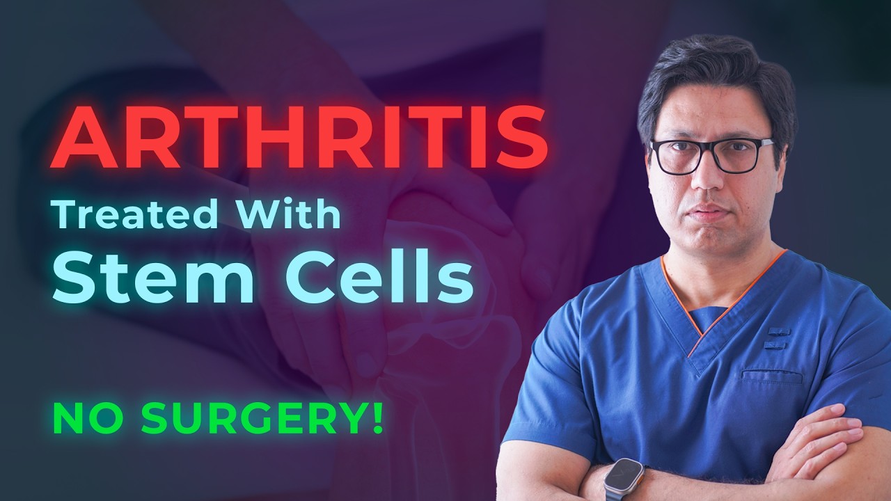 Avoid Knee Replacement &ndash; Stem Cell Therapy for Knee Arthritis | Dr. Muhammad Imran Khan