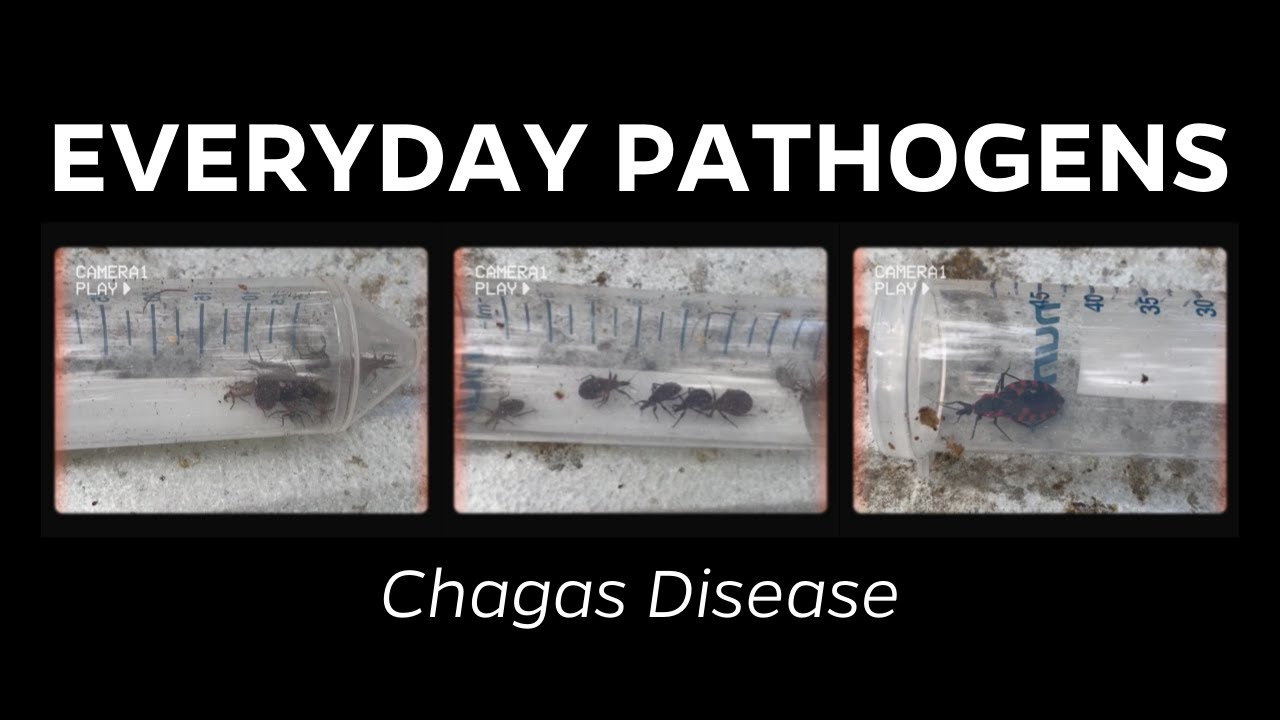 What is Chagas disease?