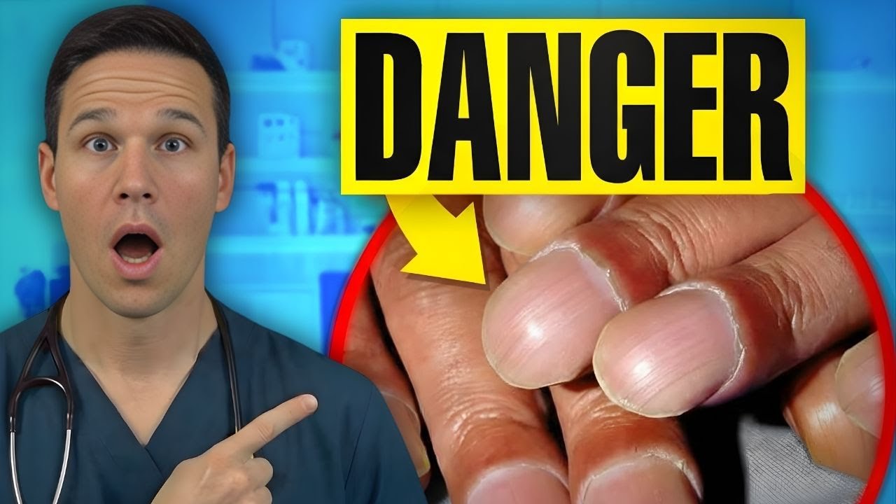 What Your NAILS Say About Your HEALTH_ Doctor Explains - Dr. Robert Harrison