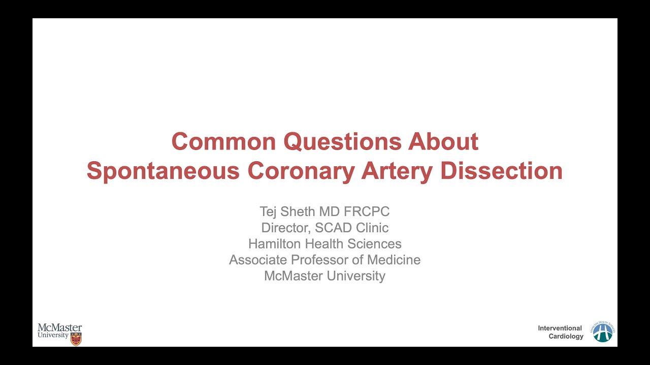 SCAD Common Questions