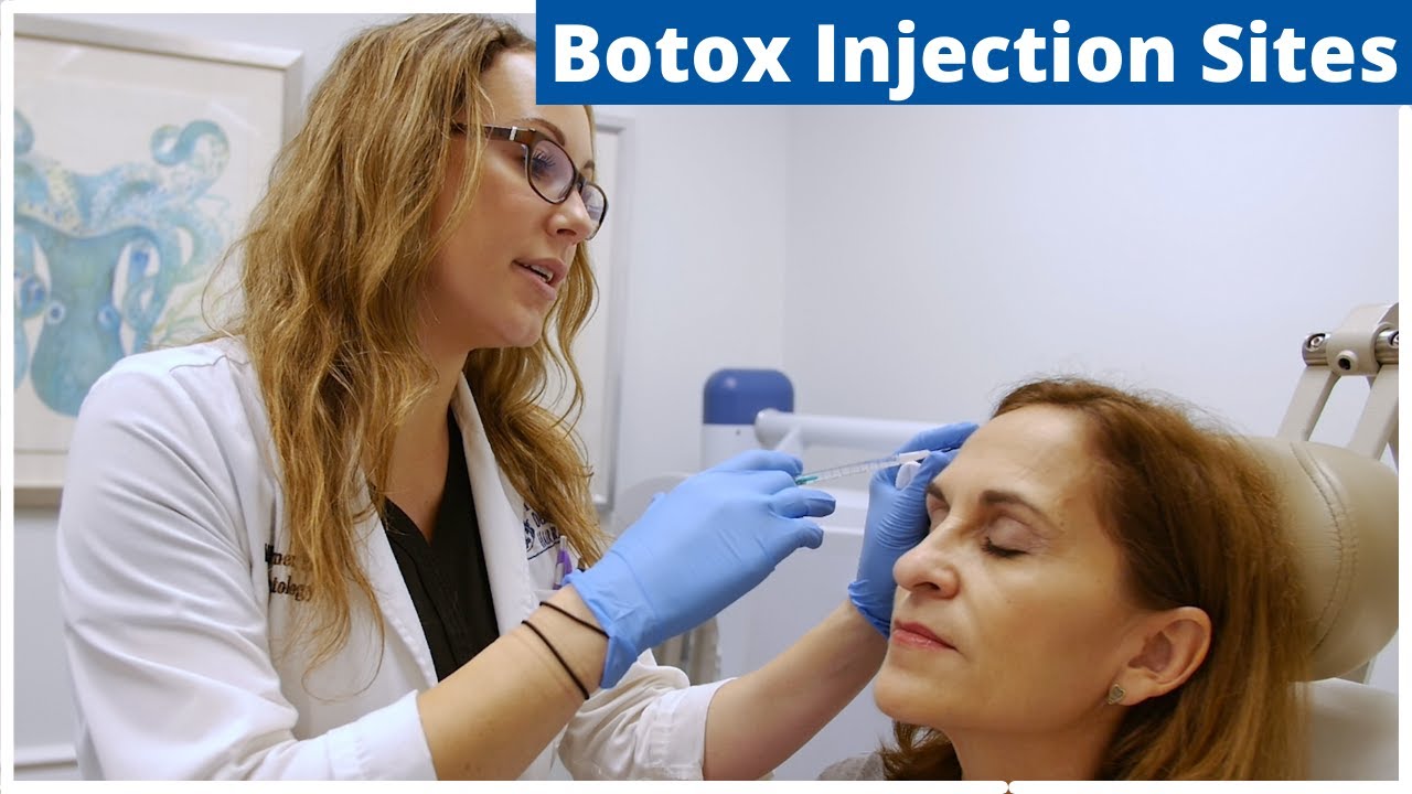 Botox Frontalis, Glabella & Nefertiti Treatment | Botox Injection Sites
