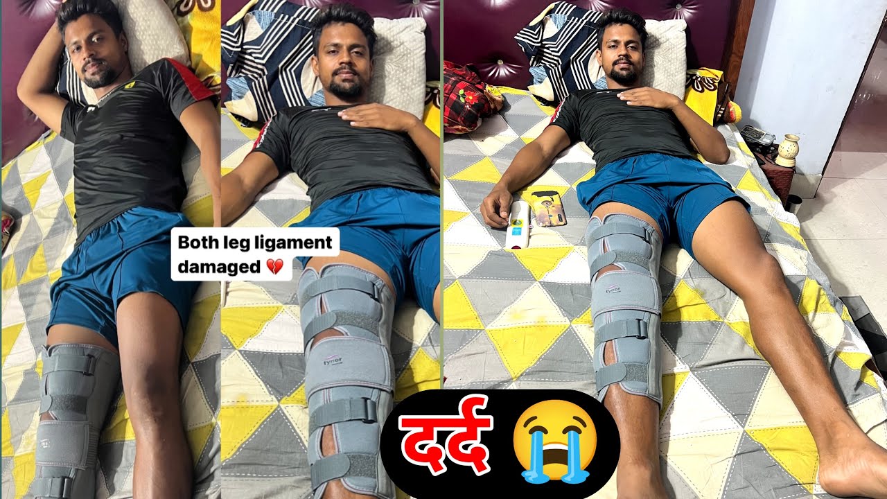 ये क्या हो गया 🥺 ज़िंदगी मे इतना तकलीफ़ ॥ Acl tear both leg ligament damaged 😭