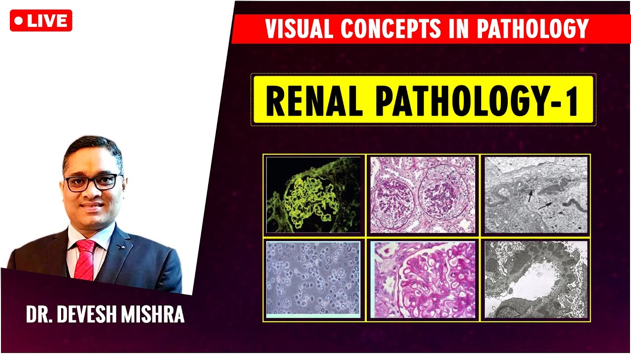 Visual concepts in Pathology: Renal Pathology-1 by Dr Devesh Mishra