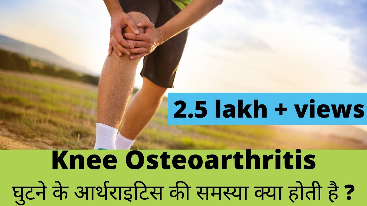 knee osteoarthritis(घुटने के आर्थ्राइटिस) explained in Hindi by Dr. Pankaj Walecha.