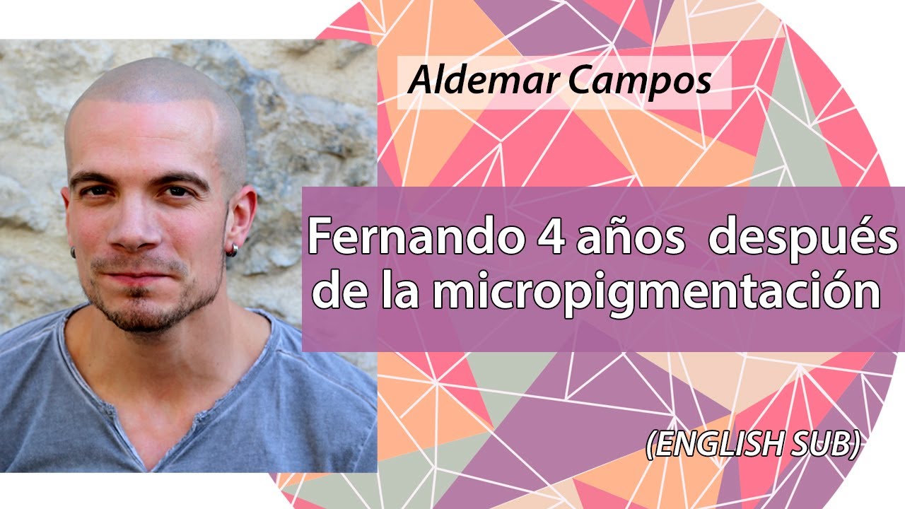 Micropigmentación Capilar 4 años ENGLISH SUB