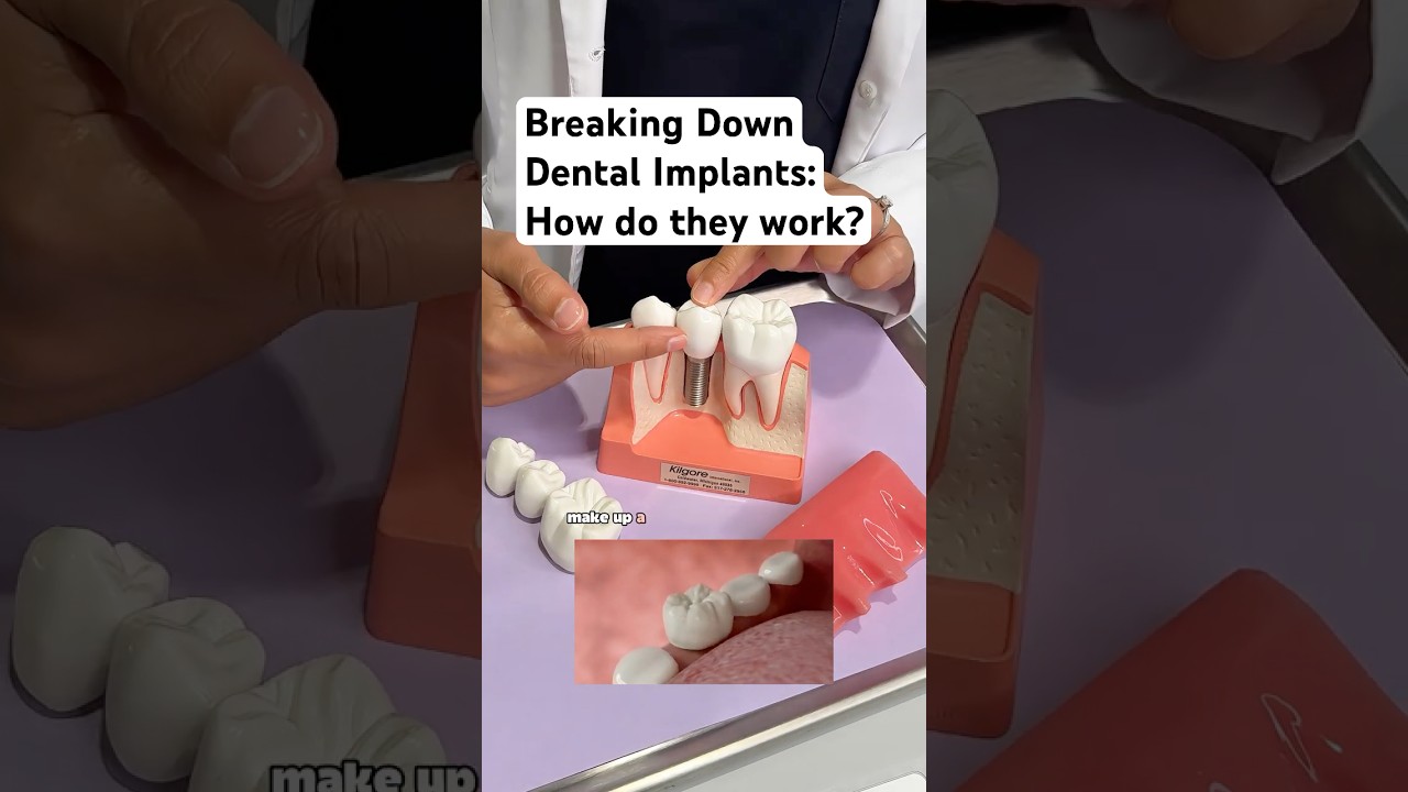 How Do Dental Implants Work? Dr. Raha Yousefi Breaks It Down  |  District Dental Surgery