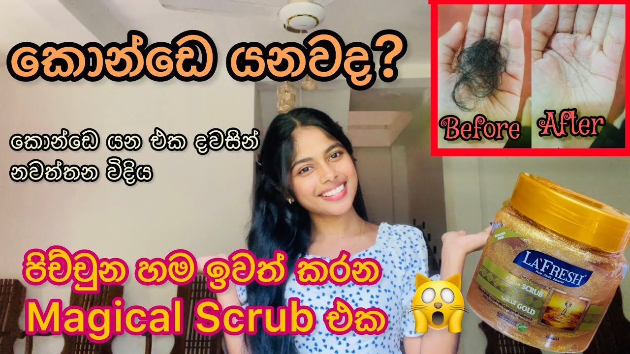 🔥Hair fall නවත්තන සුපිරිම treatments 9ක් |🌿Natural hair fall solutions in Sinhala |magical scrub එක😲
