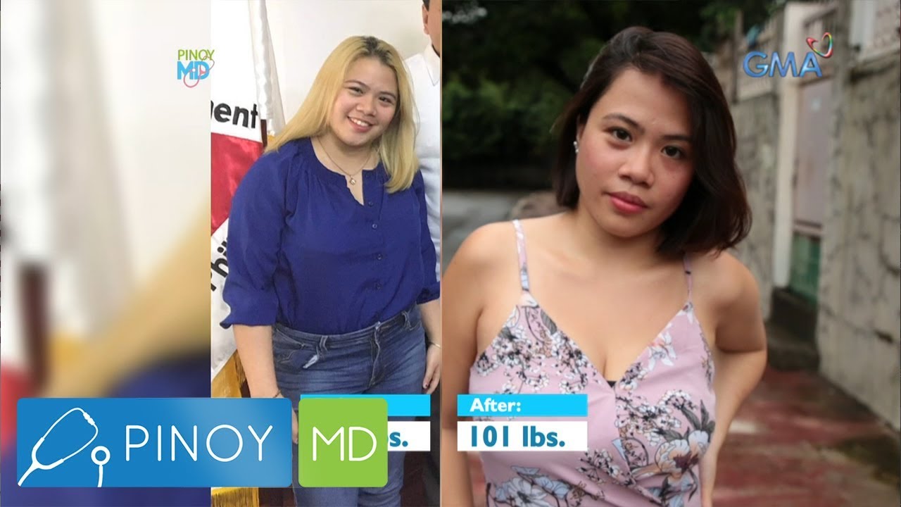 Pinoy MD: Dalaga, nagsilbing fitspiration sa kabila ng PCOS