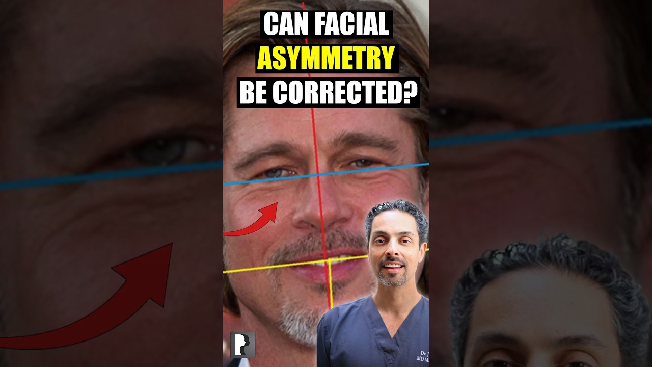 Can Facial Asymmetry be corrected? London Facial Plastic Surgeon answers! #facialsurgery