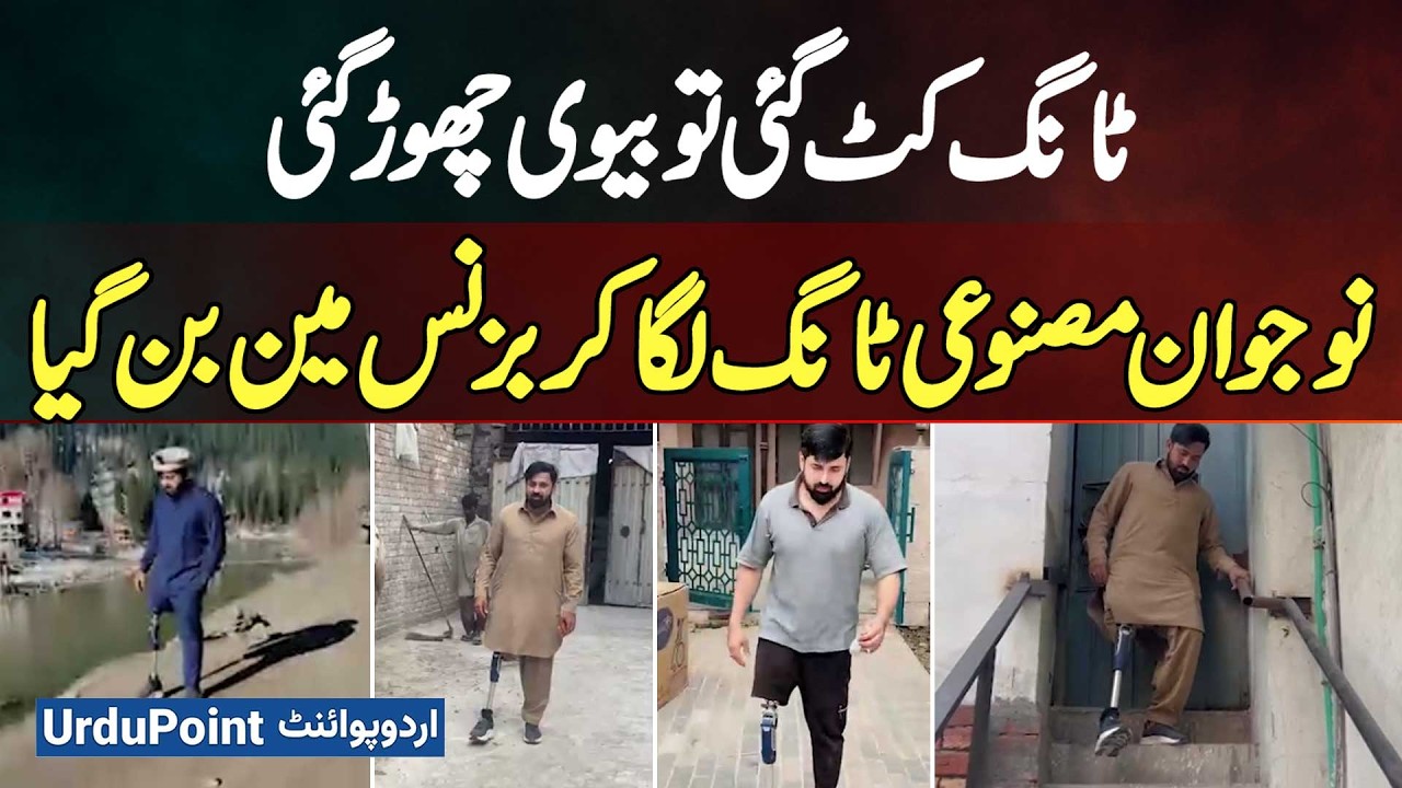 Wife Left After Leg Amputation: Pakistani Got Prosthetic Leg And Became A Businessman