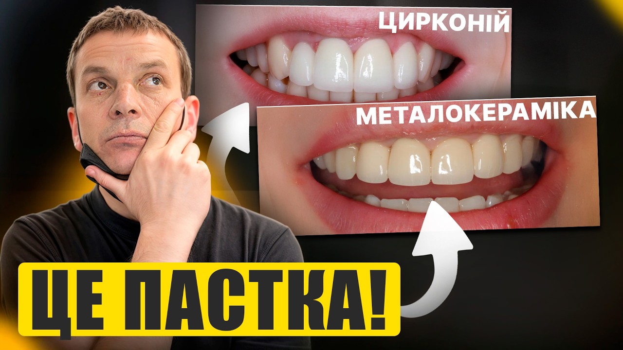 МЕТАЛОКЕРАМІКА чи ЦИРКОНІЙ? Які коронки обрати у 2025 році — поради від стоматолога