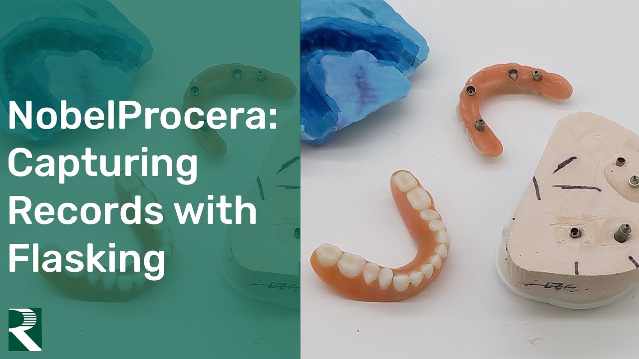 NobelProcera&reg; - Capturing Records with a Flasking Technique