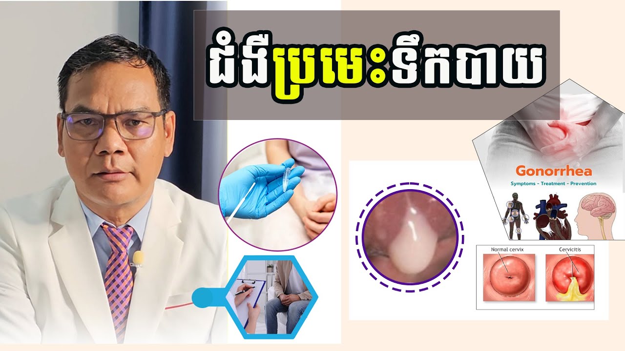ជំងឺប្រមេះទឹកបាយ/gonorrhea