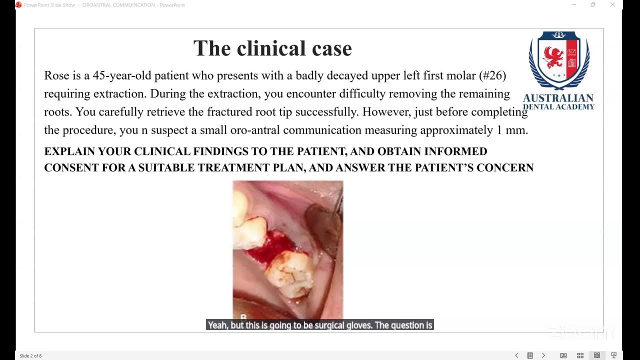 Part 1 and 2 Amalgam restoration