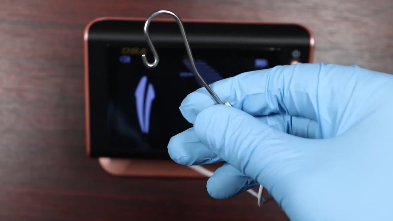 DPEX-V Apex locator Review