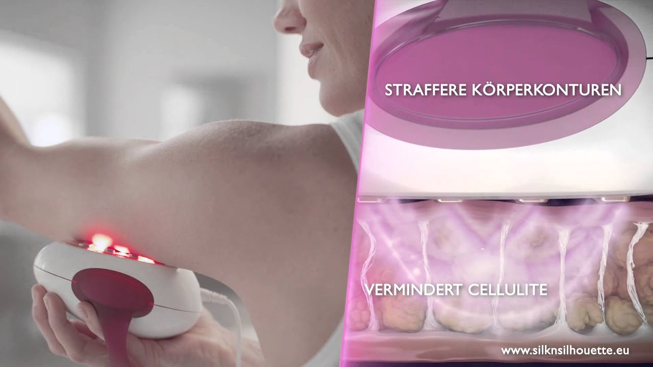 Silk'n Silhouette -  straffe Haut und weniger Cellulite ohne chirurgische Eingriffe
