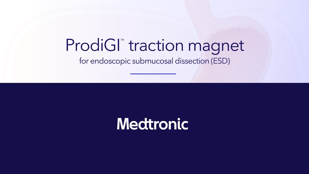 ProdiGI Traction Magnet Procedure Animation