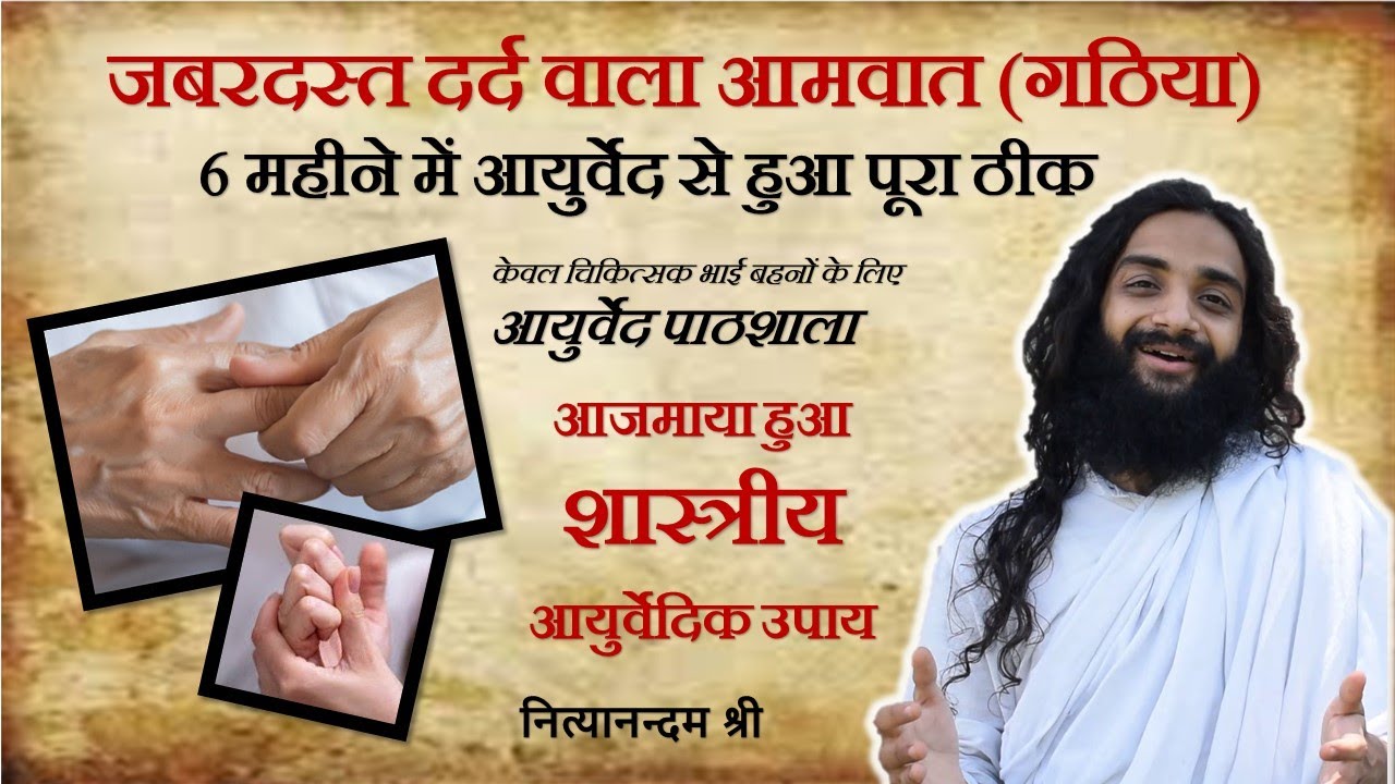 गठिया, जोड़ों का दर्द, सूजन आदि का आयुर्वेदिक इलाज | Ayurvedic Treatment of Rheumatoid Arthritis