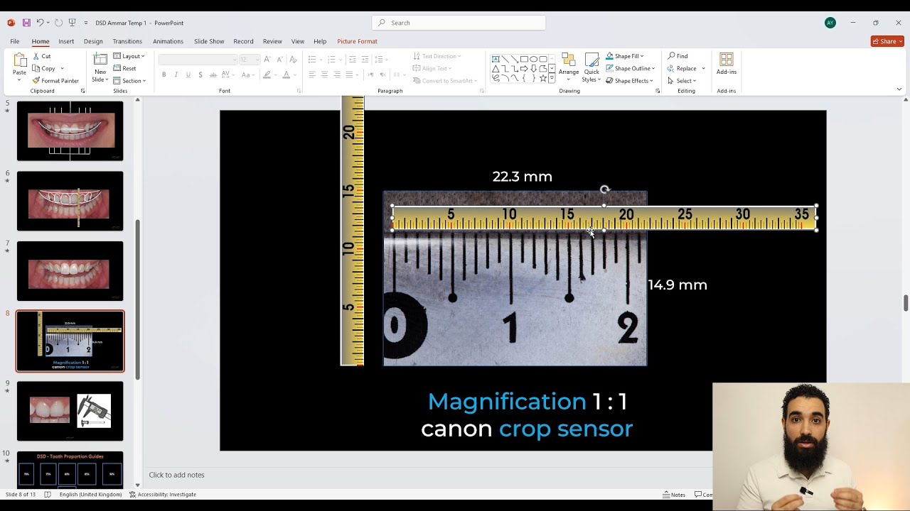 (DSD Trick)  How to transfer actual intra oral measurements to the DSD software ?