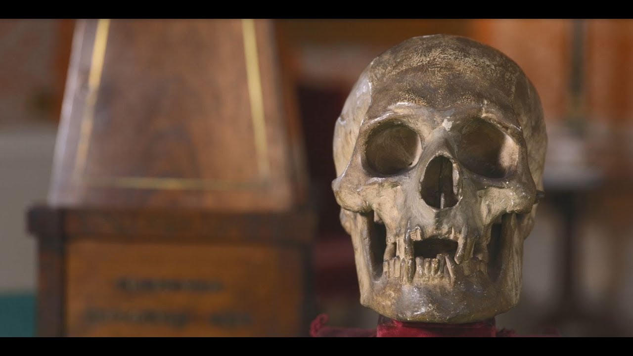 Cast of King Robert the Bruce's Skull