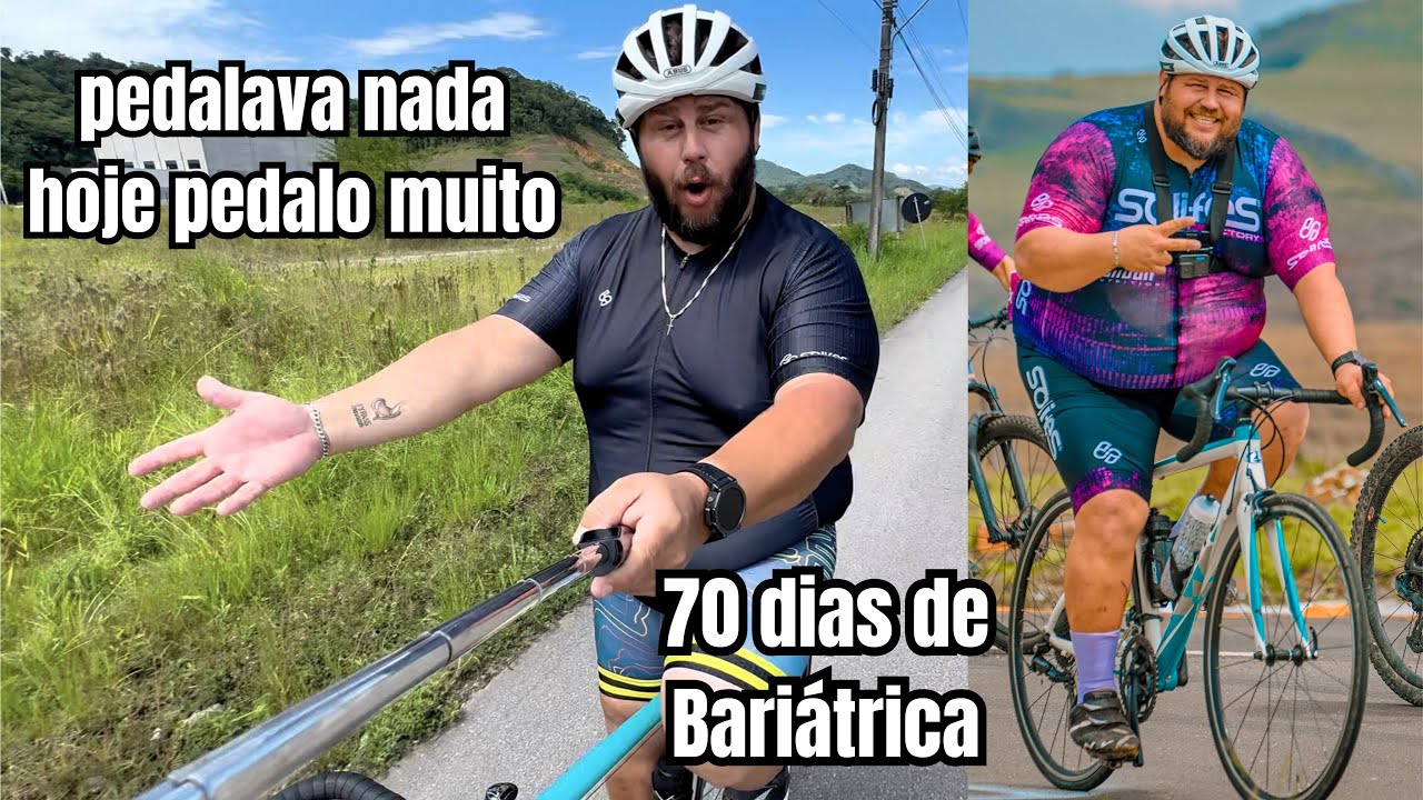 Como eram e como está sendo os Pedais após a Cirurgia Bariátrica- RAFAEL OBELIX