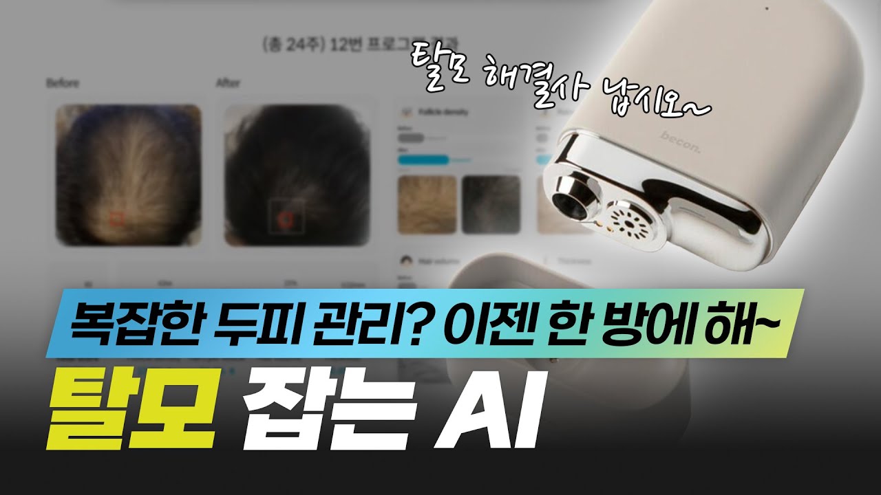 두피와 탈모 상태 진단해주는 똑똑한 AI, 비컨