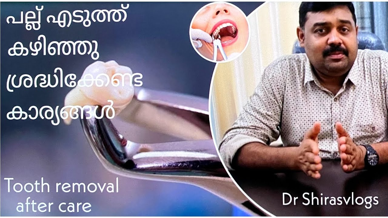 പല്ല് എടുത്തതിനു ശേഷം എന്തെല്ലാം കാര്യങ്ങൾ ശ്രദ്ധിക്കണം