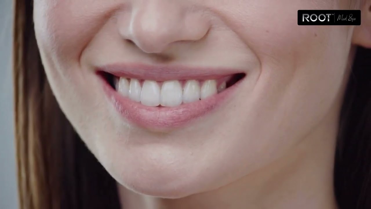 Get Naturally Fuller Lips: Lip Filler Transformations in Dallas, TX