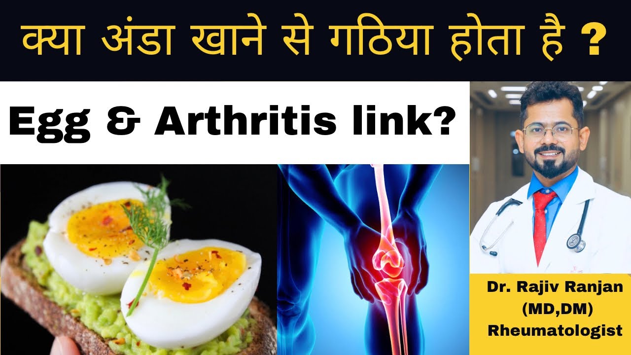 क्या गठिया मरीज़ अंडा खा सकते है ? | Arthritis & Egg Relationship | Egg & Inflammation