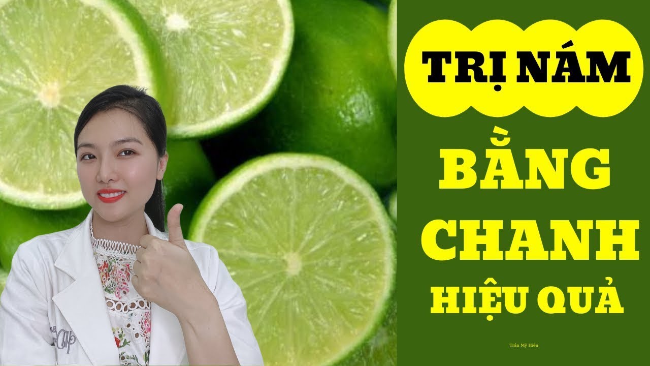 Trị n&aacute;m bằng chanh hiệu quả | Trần Mỹ Hiền