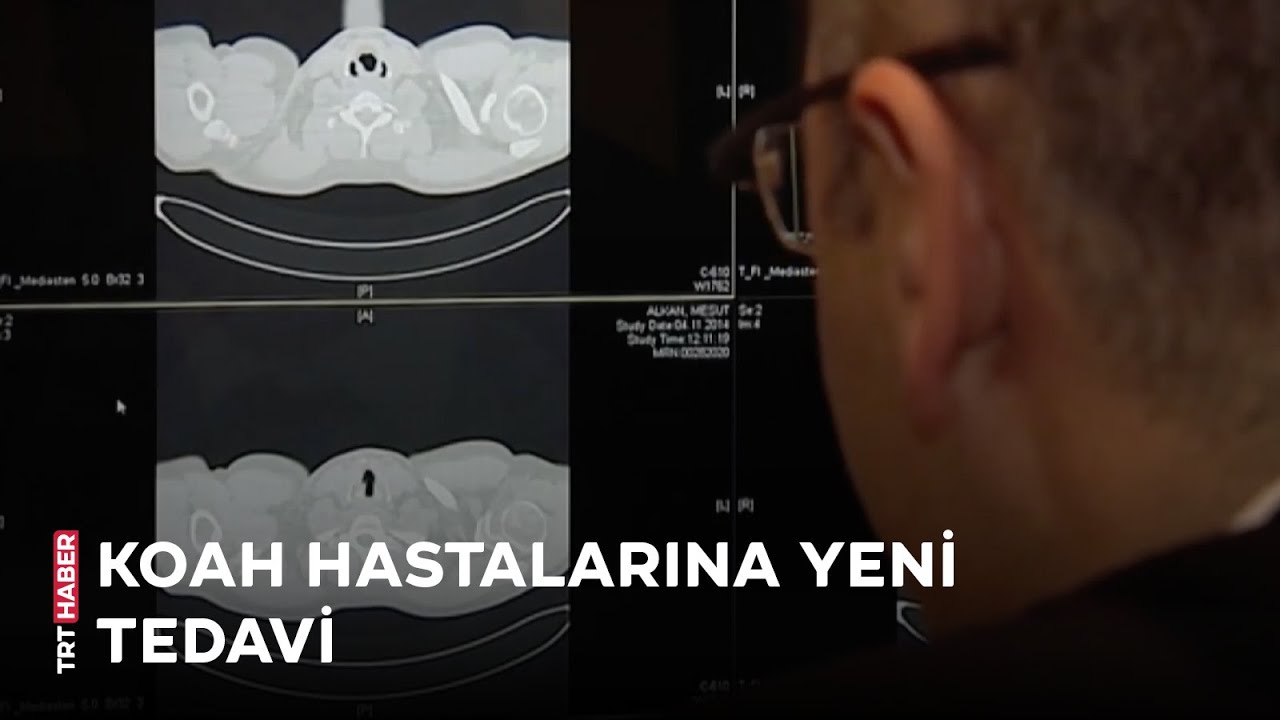 KOAH hastaları için yeni tedavi yöntemi