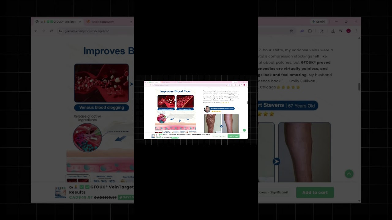 Gfouk VeinTarget Microneedle Patch Review