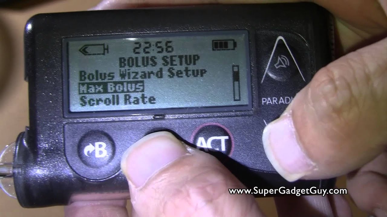 Medtronic MiniMed 523 Insulin Pump Review