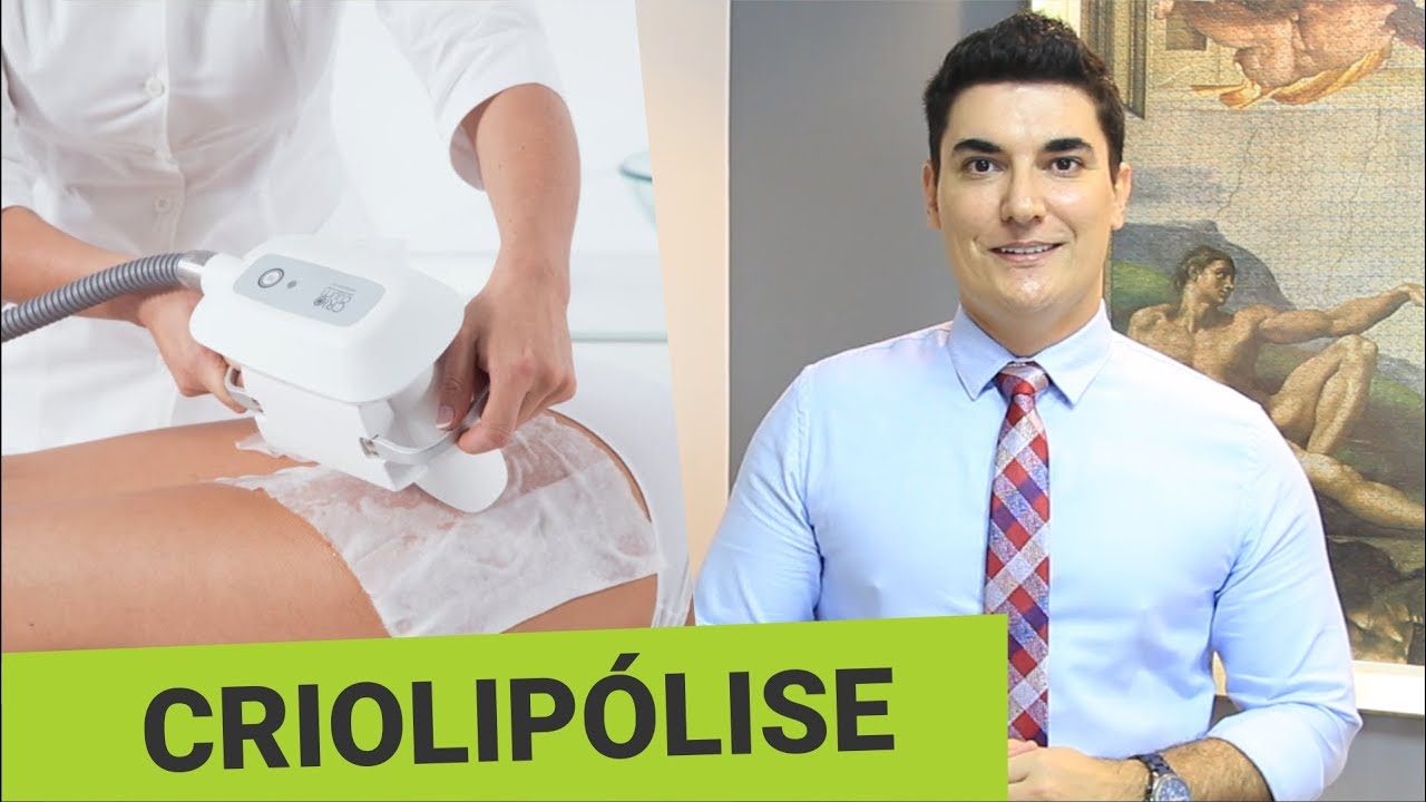 Criolipólise