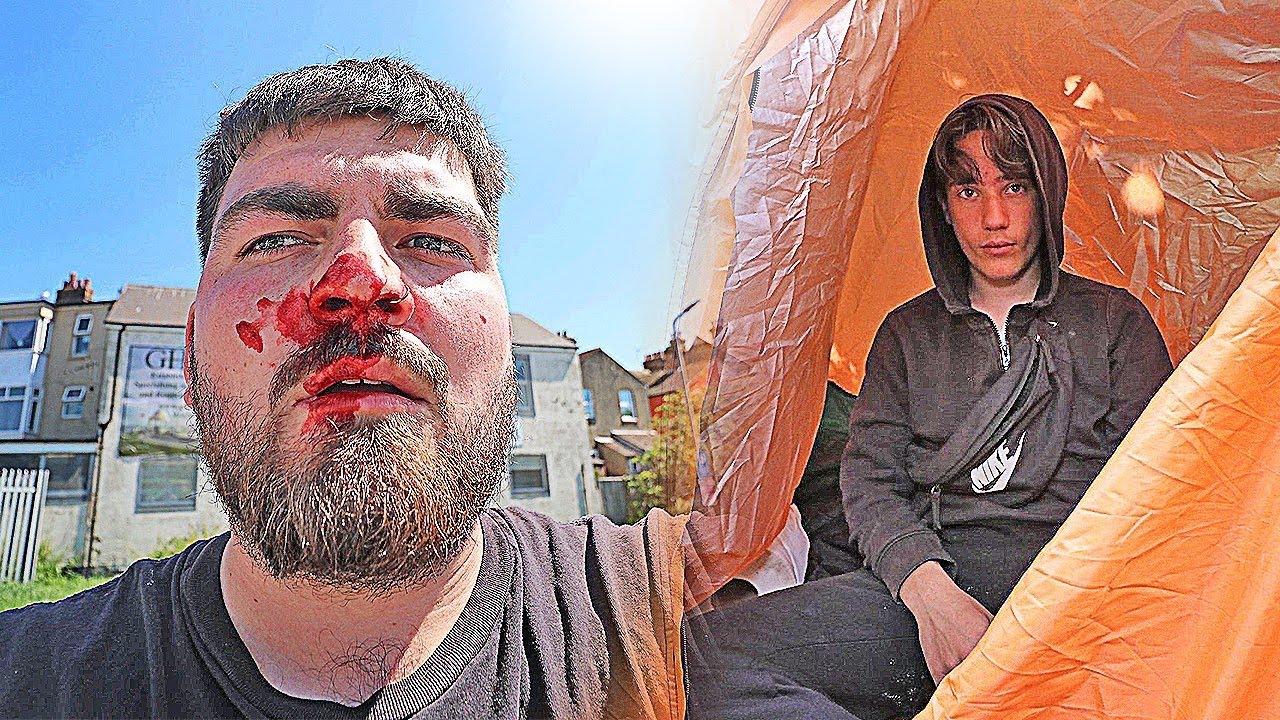 HOMELESS BOY BROKE MY NOSE… (Police Called!)