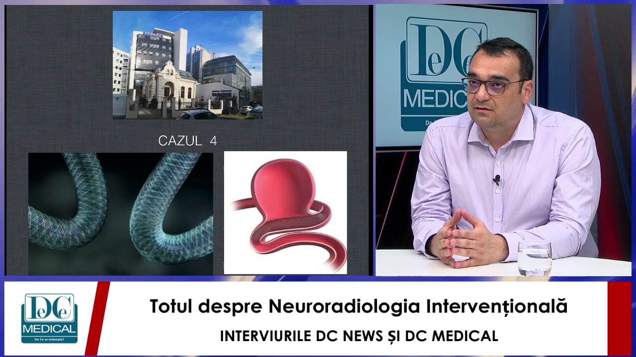 Neuroradiologia Intervențională, cu Dr Cristian MIHALEA. Interviurile DC News și DC Medical