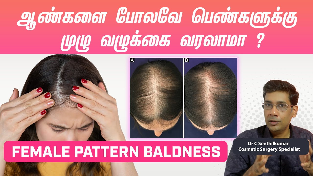 பெண்களுக்கு முடி உதிர  இது ஒரு முக்கிய காரணம்|| hairfall in women #hairlosssolution #haircare