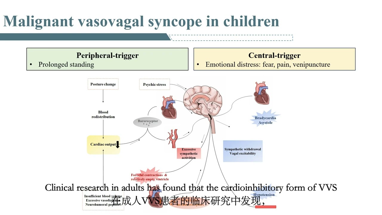 Malignant vasovagal syncope in children