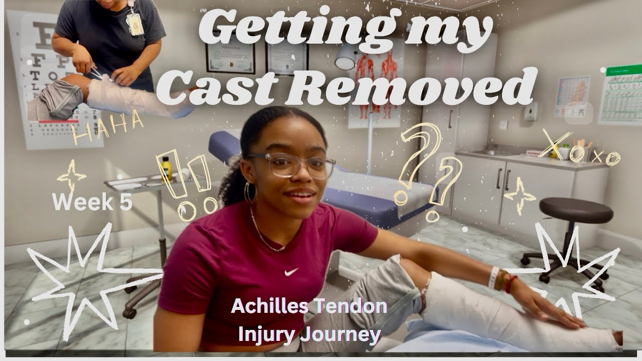 Getting my Cast off! My Achilles Tendon Injury Journey. Week 5