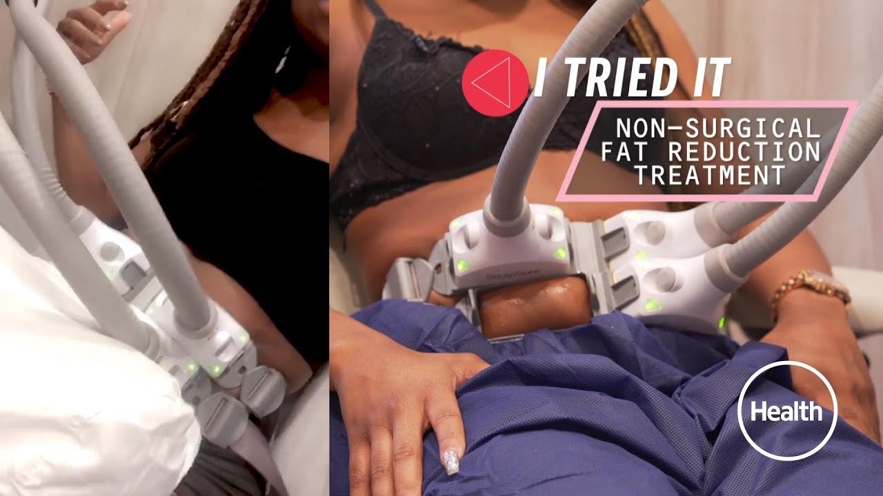 I Tried A Body Contouring Treatment--These Are My Results | Health