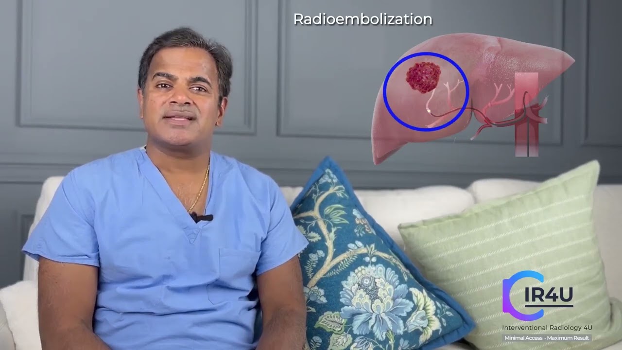 Advanced Liver Cancers: Y90 Radioembolization (TARE)