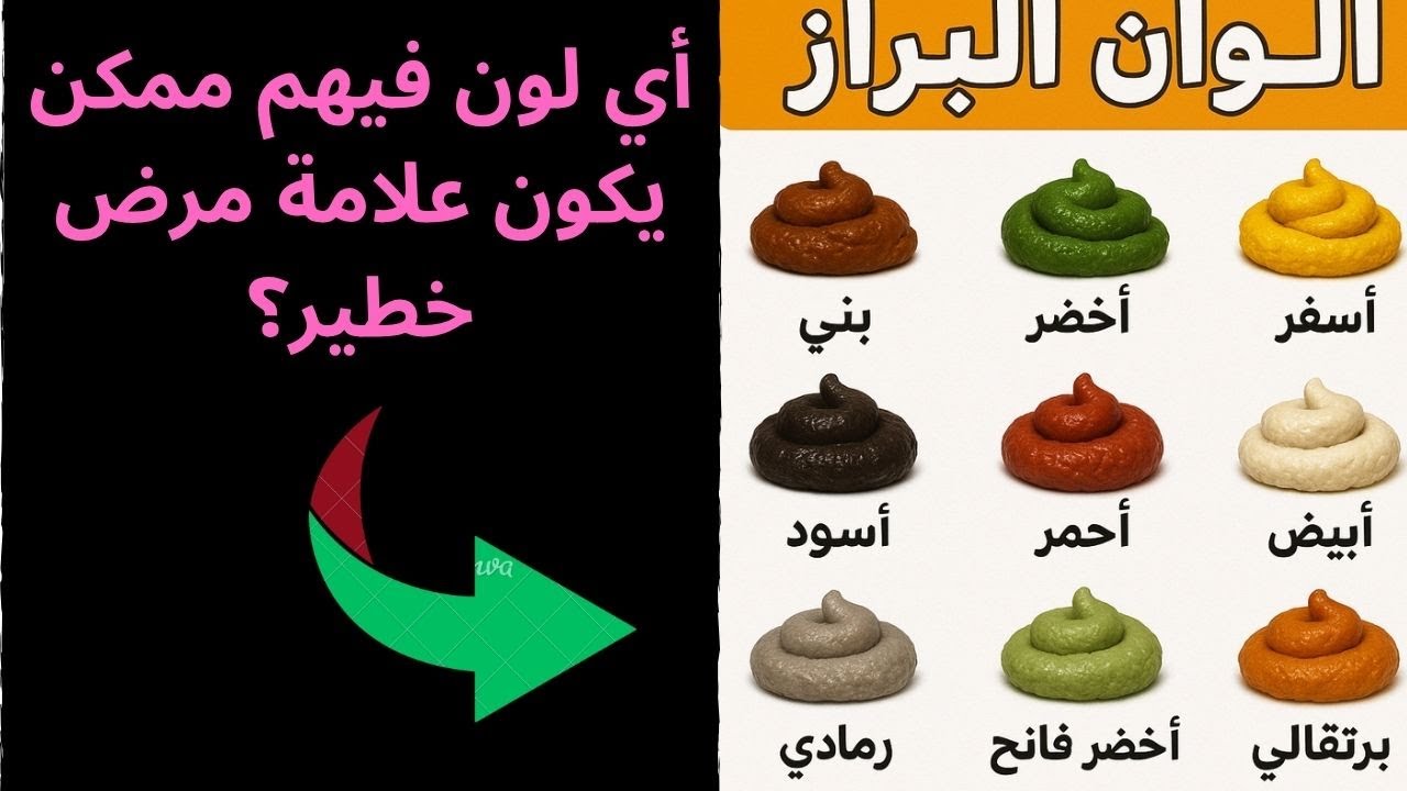 أسباب تغير لون البراز ووقت الخطر الحقيقي