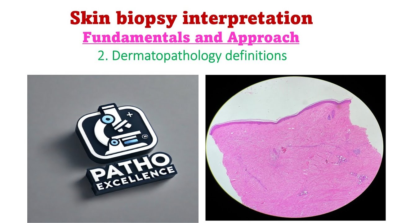Skin Biopsy Interpretation | Dermatopathology Definitions Explained | Episode 2