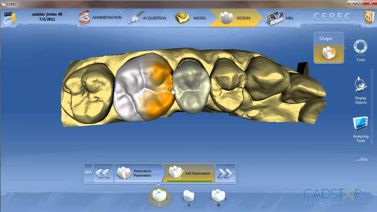CEREC 4.0 Workflow Overview